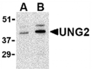 AP05615PU-N - Uracil-DNA glycosylase 2 / Cyclin-O
