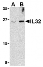 AP05618PU-N - Interleukin-32 / IL32