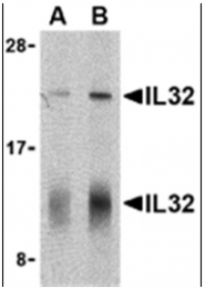 AP05619PU-N - Interleukin-32 / IL32