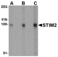 AP05701PU-N - STIM2