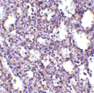 AP05701PU-N - STIM2
