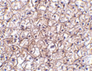 AP05706PU-N - IFNB / Interferon beta