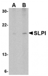 AP05707PU-N - Antileukoproteinase / ALP