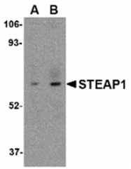 AP05708PU-N - STEAP / STEAP1