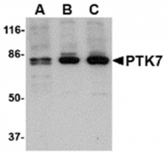 AP05710PU-N - PTK7 / CCK4