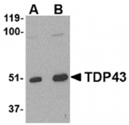 AP05713PU-N - TARDBP