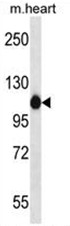 AP50071PU-N - Alpha-actinin-2 / ACTN2