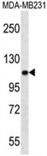 AP50072PU-N - Alpha-actinin-3 / ACTN3