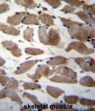 AP50072PU-N - Alpha-actinin-3 / ACTN3