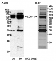 AP05718PU-N - CDK11A / CDC2L2