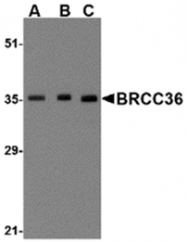 AP05726SU-N - BRCC3