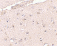 AP05726SU-N - BRCC3