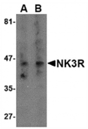 AP05734PU-N - Tachykinin receptor 3 (TACR3)