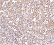 AP05736PU-N - ORAI1