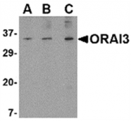 AP05738PU-N - ORAI3