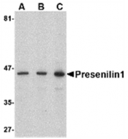 AP05739PU-N - Presenilin-1