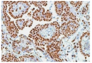 AM00403SU-L - WT1 / Wilms tumor protein