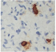 AM10146SU-N - Tryptase beta-1 (TPSAB1)