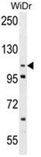 AP50078PU-N - ADAM19 / MLTNB