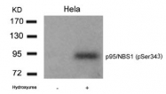 AP02356PU-S - Nibrin