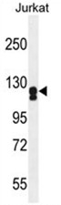 AP50086PU-N - Adenylate cyclase type 2