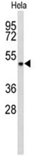 AP50091PU-N - Alcohol dehydrogenase 6 / ADH6