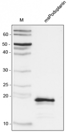 AR31060PU-N - Podoplanin
