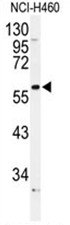 AP50099PU-N - Alpha-1B adrenergic receptor / ADRA1B