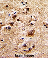 AP50099PU-N - Alpha-1B adrenergic receptor / ADRA1B
