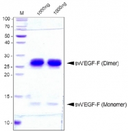 AR31064PU-N - VEGF-F / svVEGF