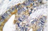 AP06199PU-N - Cytokeratin 18