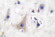 AP06145PU-N - GLUT3 / SLC2A3