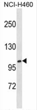 AP54591PU-N - Xylosyltransferase 1
