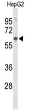 AP50105PU-N - Afamin / AFM