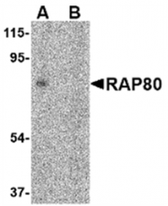 AP05740PU-N - UIMC1 / RAP80