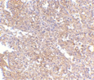 AP05740PU-N - UIMC1 / RAP80