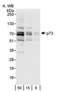 AP05754PU-N - Tumor protein p73 (TP73)