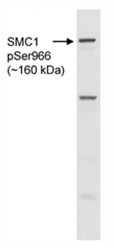 AP05757PU-N - SMC1A / SMC1