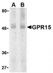 AP05784PU-N - GPR15
