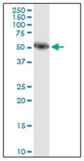 AM31902PU-N - Alpha-amylase 1 / AMY1
