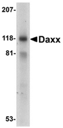 AP05800PU-N - DAXX