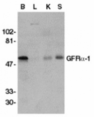 SP1086P - GFRA1 / GDNFR-alpha