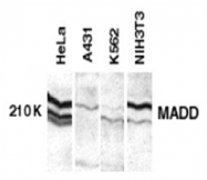 SP1241P - MADD