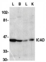 SP1235P - DFFA / ICAD