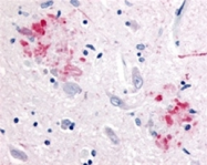 AP05818PU-N - Amyloid beta A4 protein / APP