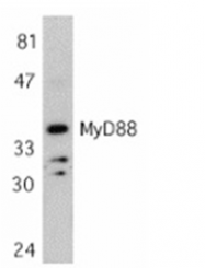 SP1273P - MYD88