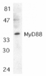SP1274P - MYD88