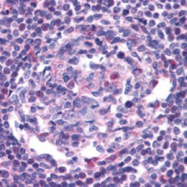 AP05821PU-N - CD195 / CCR5