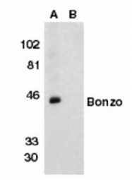 SP1286P - CD186 / CXCR6