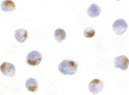 AP05825PU-N - Acinus / ACIN1